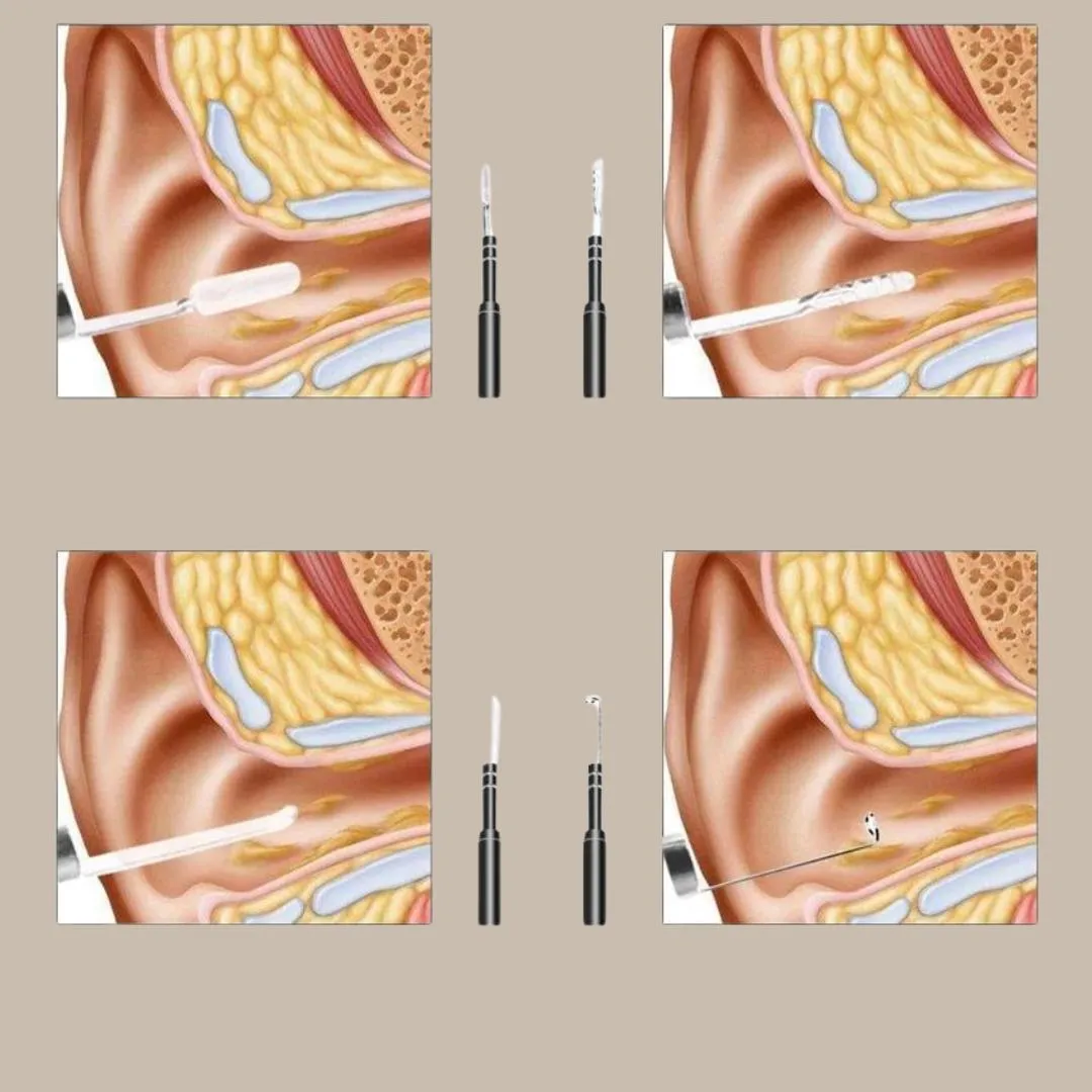 Medical In Ear Cleaning Mini Camera