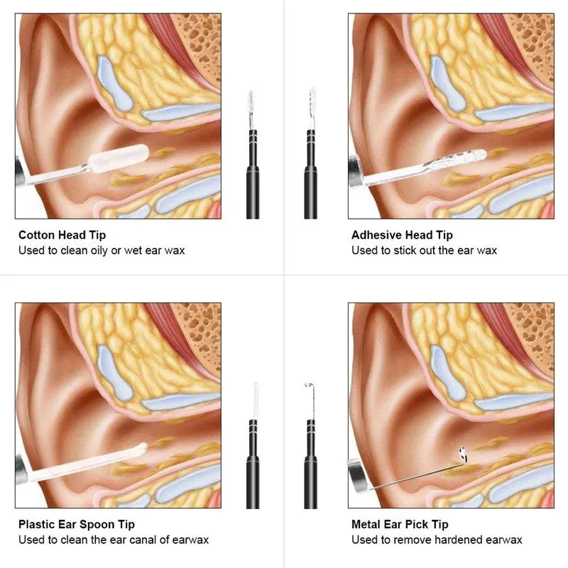 Medical In Ear Cleaning Mini Camera